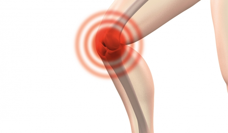 knee pain patellofemoral