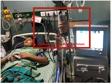 CRRT machine in Sapra Hospital