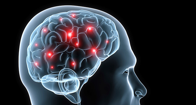Epilepsy day 2019