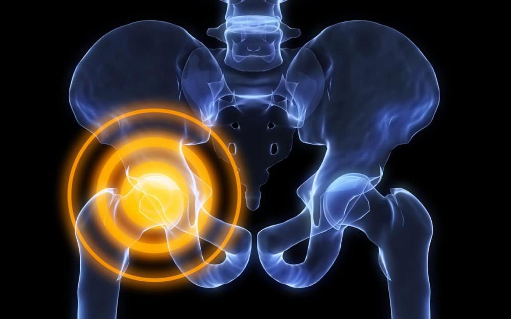 Hip flexor Strain