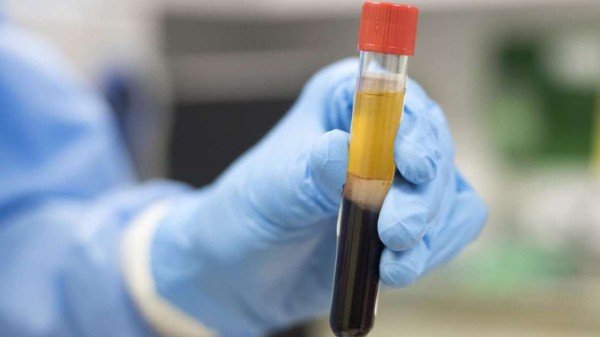 CONVALESCENT PLASMA THERAPY