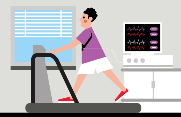 Cardiac Stress test